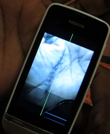 Rashed has a picture in his phone of the stitches on his palm